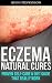 Eczema Natural Cures by Alvin Hopkinson