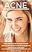 Acne: The Ultimate Guide On How To Both Prevent And Get Rid Of Your Blemishes To Regain Your Clear Skin