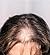 Hair Loss: Hair Loss for Wo...