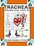 Tracheas: Why We Love Them So