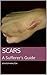 SCARRED FOR LIFE: A Guide to Living with Scars