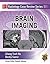 Radiology Case Review Series: Brain Imaging