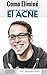 Como Eliminé el ACNE: Conoc...