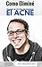 Como Eliminé el ACNE by Alejandro Alba