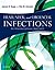 Head, Neck and Orofacial Infections by James R. Hupp