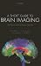 A Short Guide to Brain Imaging