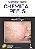 Step by Step Chemical Peels