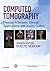 Computed Tomography: Physical Principles, Clinical Applications, and Quality Control