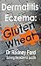Dermatitis Eczema: Gluten W...