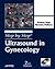Ultrasound in Gynecology
