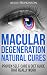 Macular Degeneration Natura...