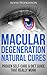 Macular Degeneration Natural Cures: Proven Self-Care Guide & Diet That Really Work (Top Rated 30-min Series)