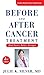 Before and After Cancer Treatment (A Johns Hopkins Press Health Book)
