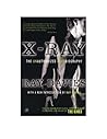 X-Ray: The Unauth...