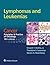 Lymphomas and Leukemias: Cancer: Principles & Practice of Oncology, 10th edition