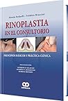 Rinoplastia en El Consultorio (Spanish Edition)