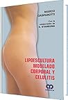 Lipoescultura, modelado corporal y celulitis (Spanish Edition)