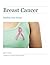 Breast Cancer by Starr Fuentes