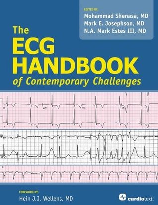 The ECG Handbook of Contemporary Challenges (Paperback)