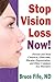 Stop Vision Loss Now!: Prev...