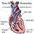 New Heart for Humanity
