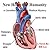 New Heart for Humanity by Bill Ley