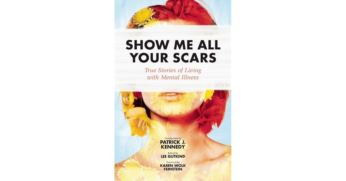 Show Me All Your Scars True Stories of Living with Mental Illness by