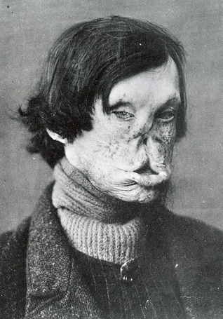 El hombre que quiso curarse (Unknown Binding)