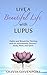 Live a Beautiful Life with Lupus: Habits and Rituals for Thriving with an Autoimmune Disease--Body, Mind, and Spirit