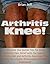 Arthritis Knee! …Discover the Secret Tips for Knee Arthritis Pain Relief with the Special Arthritis Diet and Arthritis Exercises That Works For a Quick Rheumatoid Arthritis Treatment!