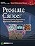 Prostate Cancer by Adam P. Dicker