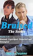 Bruised Series