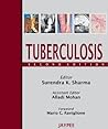 Tuberculosis