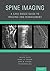 Spine Imaging: A Case-Based...
