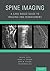 Spine Imaging: A Case-Based Guide to Imaging and Management