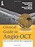 Clinical Guide to Angio-OCT...