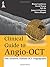 Clinical Guide to Angio-OCT: Non Invasive, Dyeless OCT Angiography