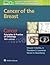 Cancer: Principles & Practice of Oncology. Cancer of the Breast