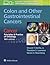 Colon and Other Gastrointestinal Cancers: Cancer: Principles & Practice of Oncology, 10th edition