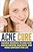 Acne Cure: Natural Remedies to Cure Acne and Be Happier, Healthier, and More Confident for Life (acne remedy, pimples, blackheads, acne no more)