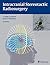 Intracranial Stereotactic Radiosurgery