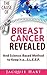 The Cause of Breast Cancer Revealed: And Science-Based Method to Keep it a...S.L.E.E.P.