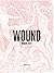 Wound