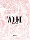 Wound