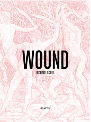 Wound