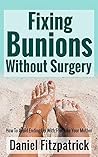 Fixing Bunions Without Surgery: How To Avoid Ending Up With Feet Like Your Mother