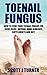 Toenail Fungus: How to Cure...