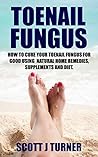 Toenail Fungus: How to Cure your Toenail Fungus for Good using Natural Home Remedies, Supplements and Diet