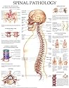 Spinal Pathology - Quick Reference Chart: Full illustrated
