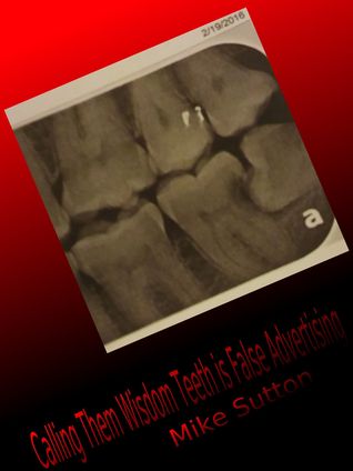 Calling Them Wisdom Teeth is False Advertising